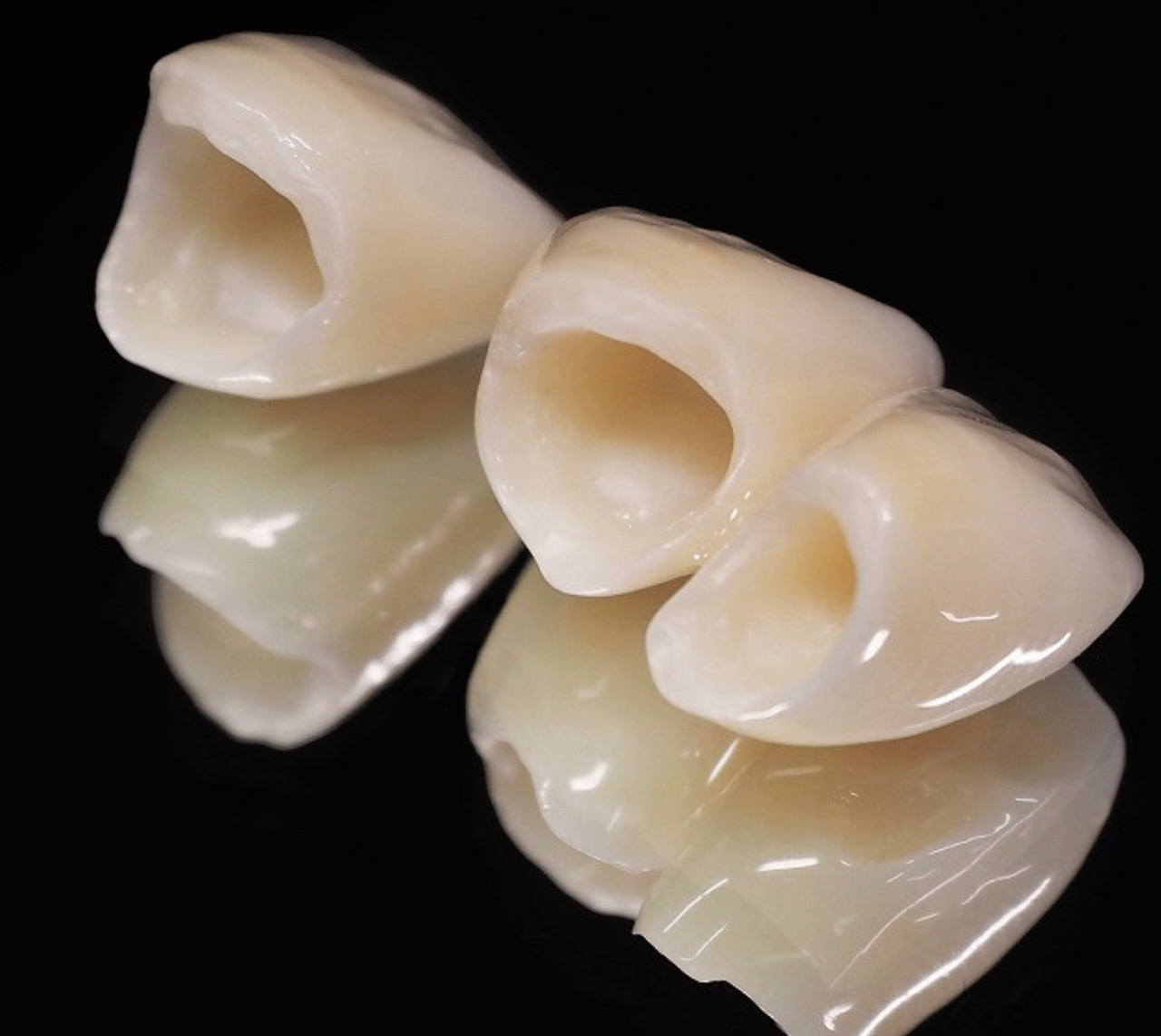 オールセラミックスの画像